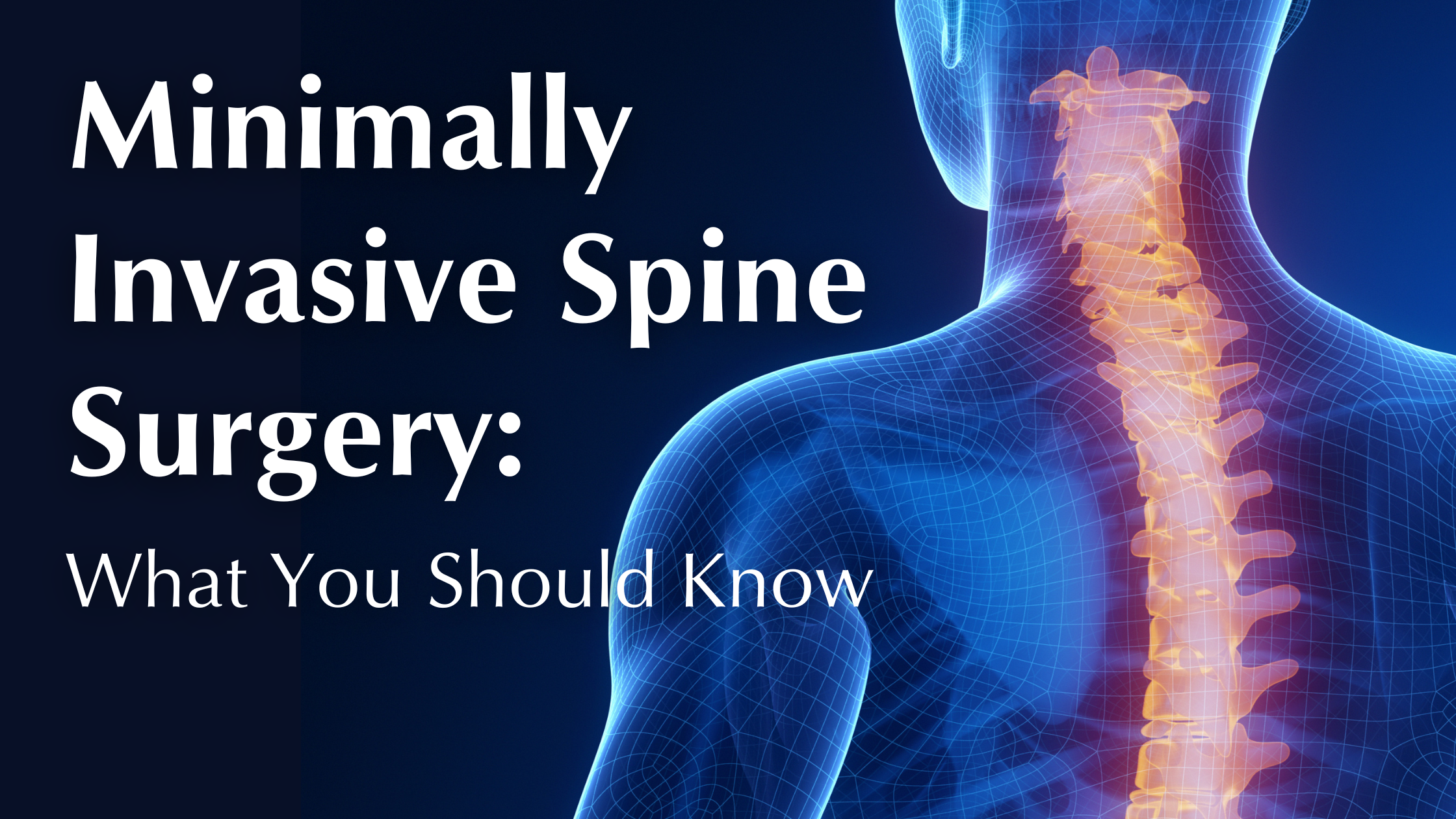 Minimally Invasive Spine Surgery